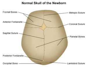newborn skull sutures