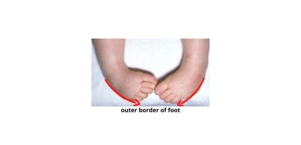 walking on outer borders of the feet